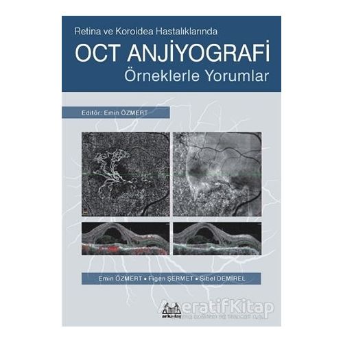Retina ve Koroidea Hastalıklarında OCT Anjiyografi - Sibel Demirel - Arkadaş Yayınları